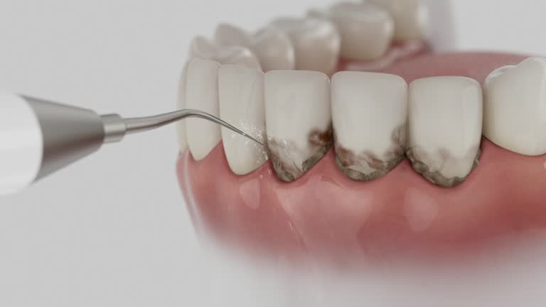 Trusted Teeth Cleaning And Checkup service in Ashland, MO - Dentist Open Now